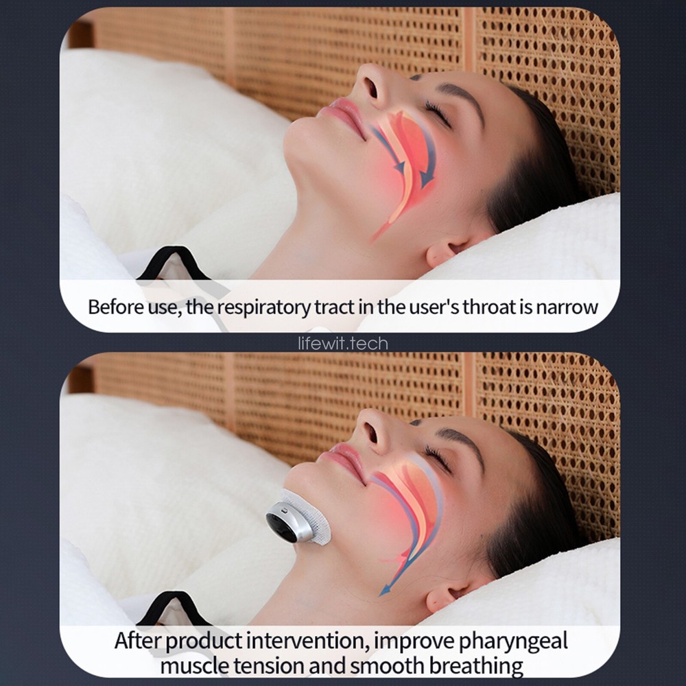 Professional Adjustment Anti-Snore Device Breathe Easy Smart Snoring Solution