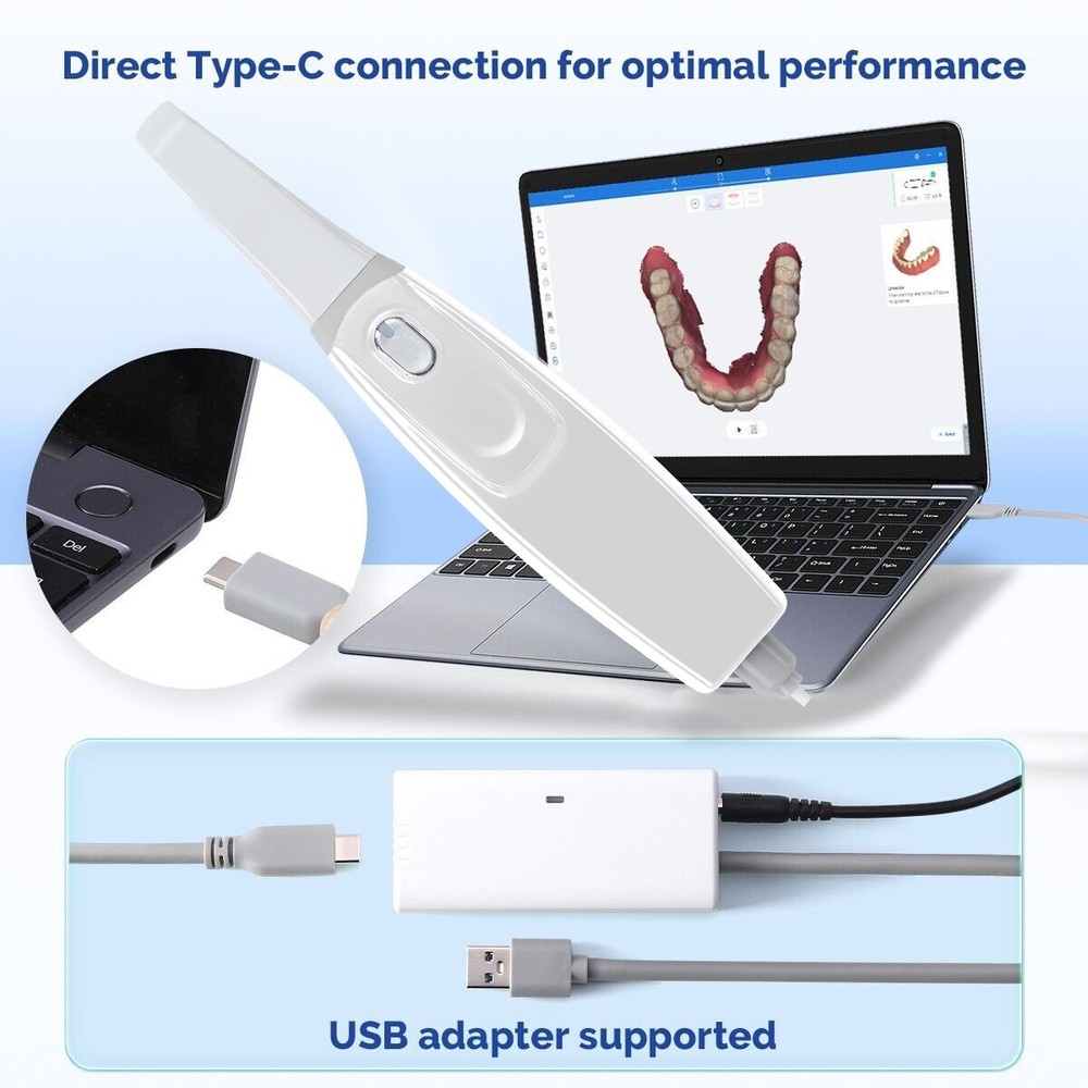 PRO Digital Dental Intraoral 3D Scanner with Scanning Software