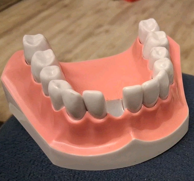 Bottom Teeth Model With Removable Teeth One Missing
