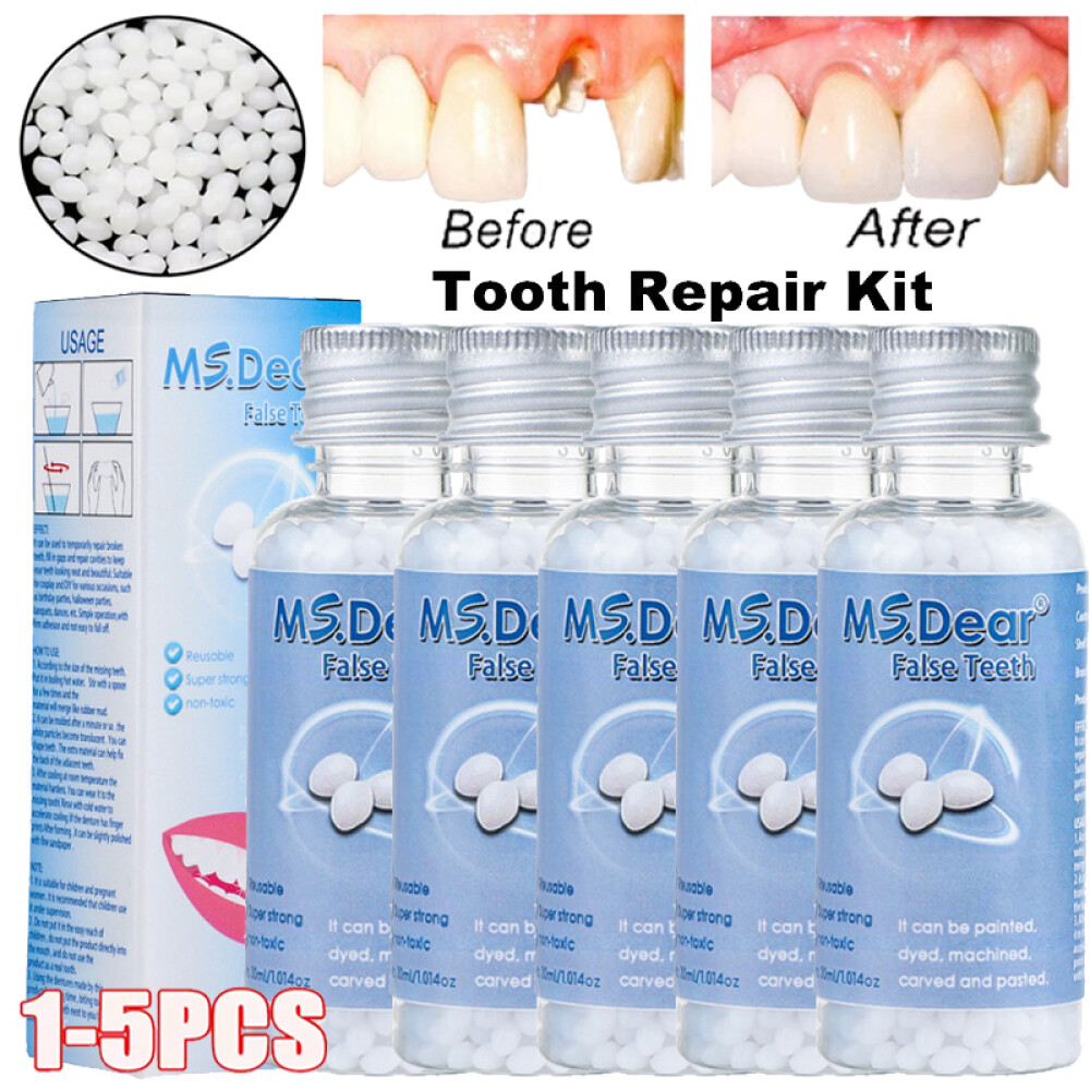 Tooth Repair Beads Granules Temporary Tooth Glue Reusable Moldable False Teeth