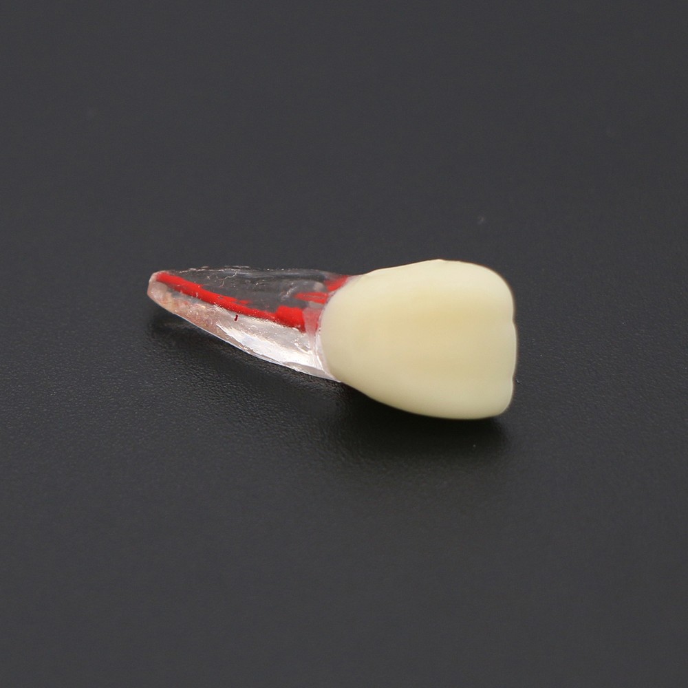 Dental Root Canal RCT Block Pulp Cavity Practice Model for Endo File Study Teeth