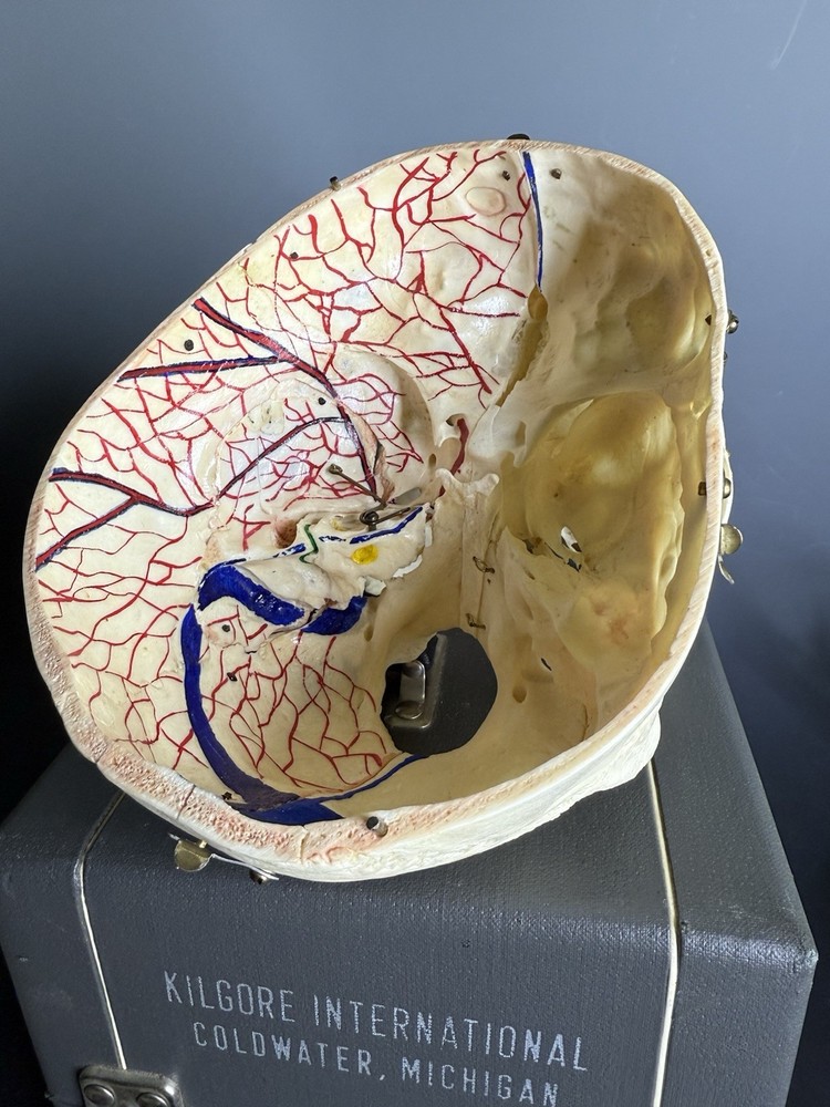Kilgore Medical Anatomical Model