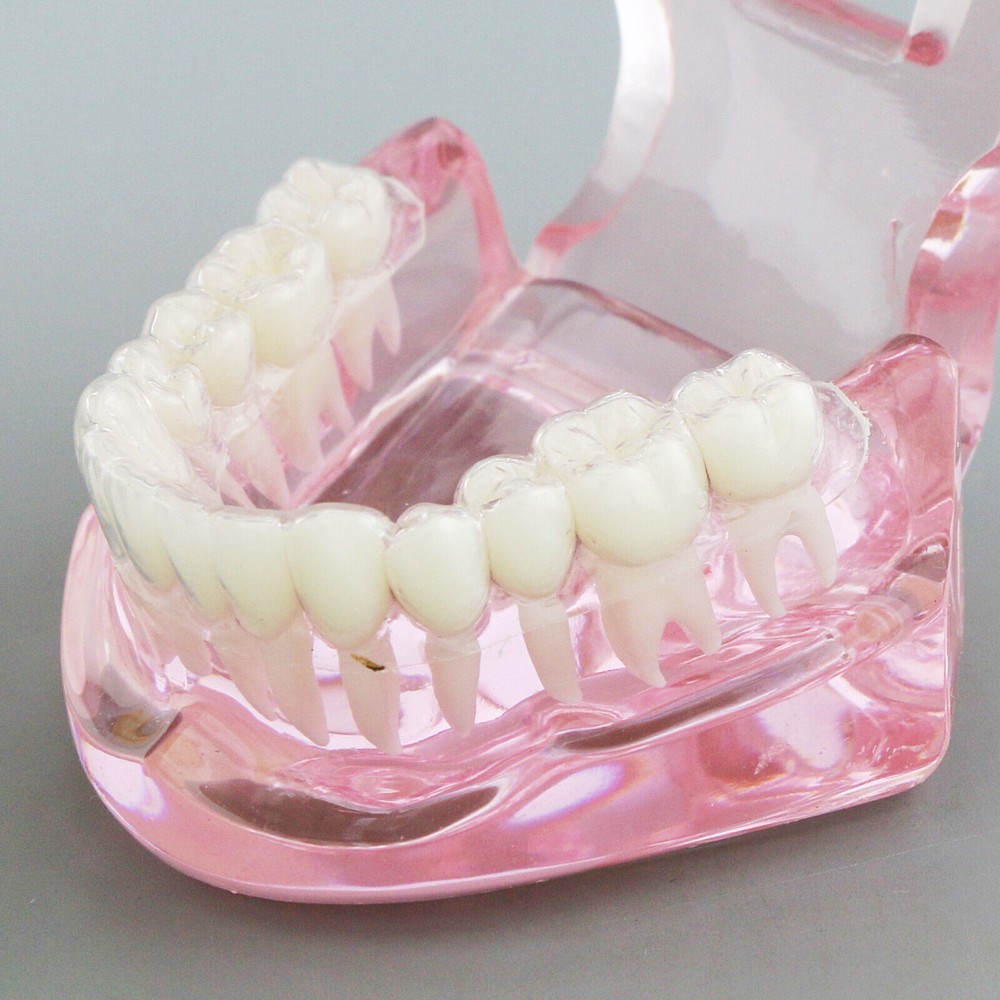 Dental Typodont Model Self-ligating Metal Bracket Ceramic Transparent Retainer