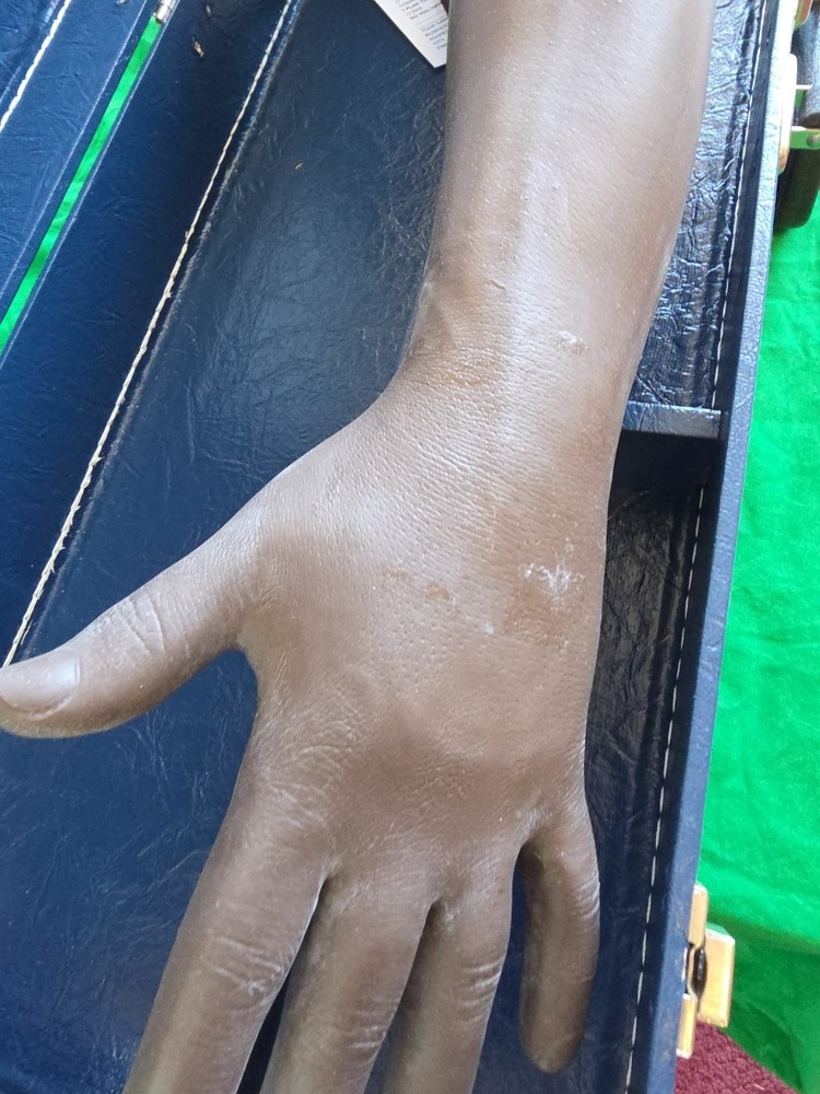 Nasco Life Form LF698 Phlebotomy IV Injection Training Arm