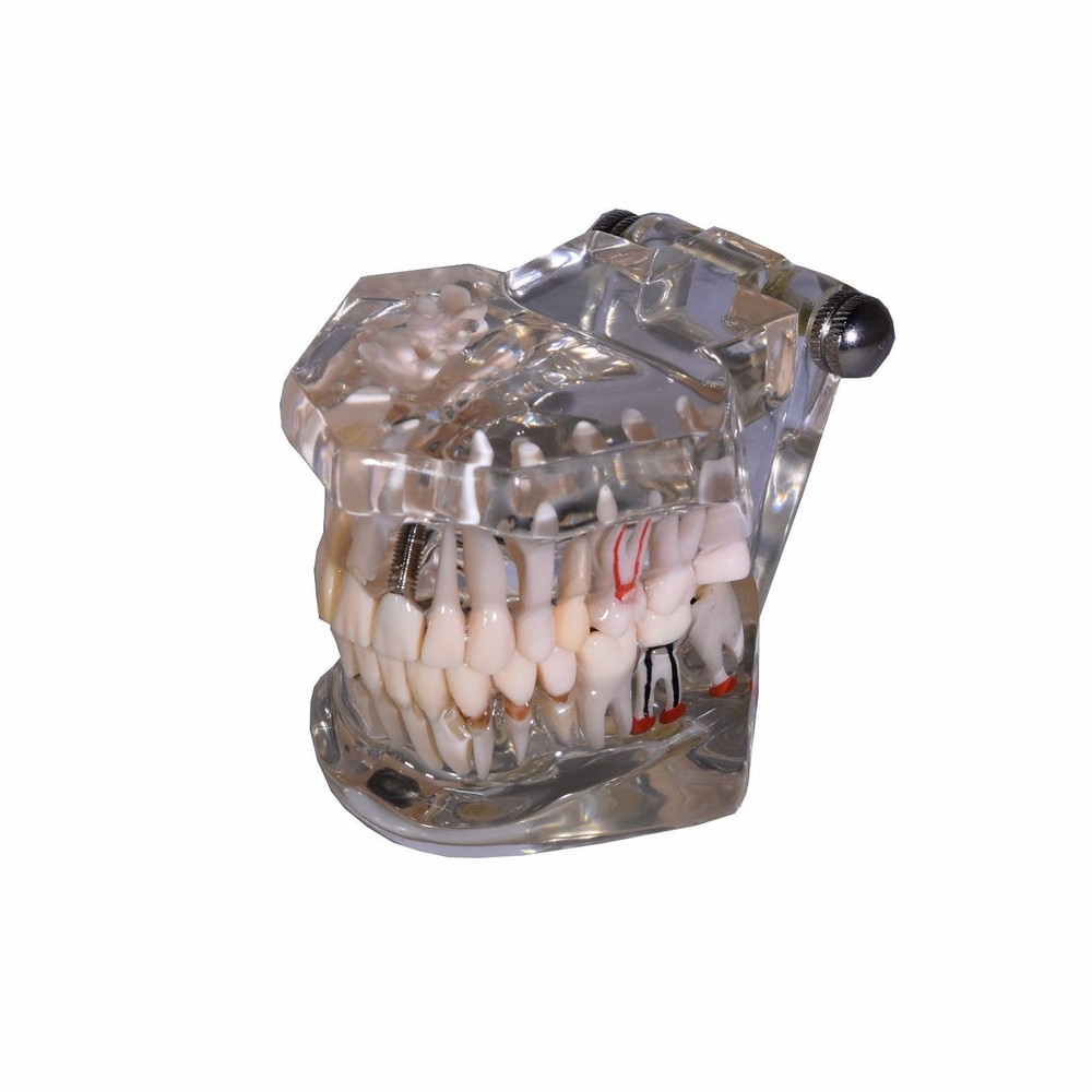 Redland Dental Demonstration Teeth Educational Model And Sales -