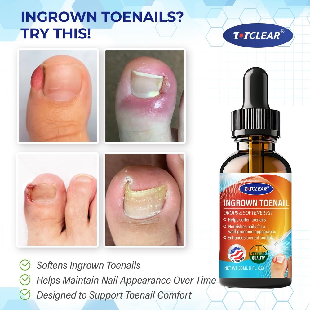 Ingrown Toenail Relief Kit - Tool Drops - 30ml - Effective Solution