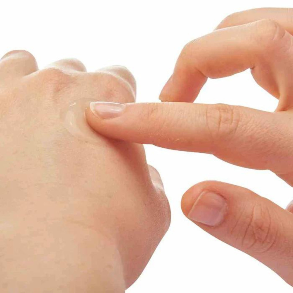 After Bite Xtra Itch Relieving Gel: 0.7 fl. oz.