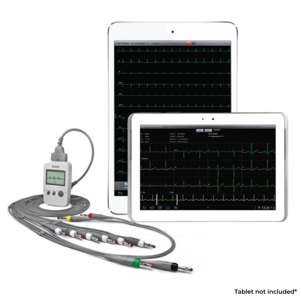 OPEN BOX EDAN PADECG Mobile ECG Solution iOS - 12-Lead ECG