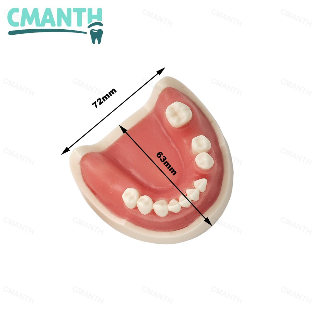 US Dental Implant Model Soft Gums Model Drilling Training Open Suture Practice