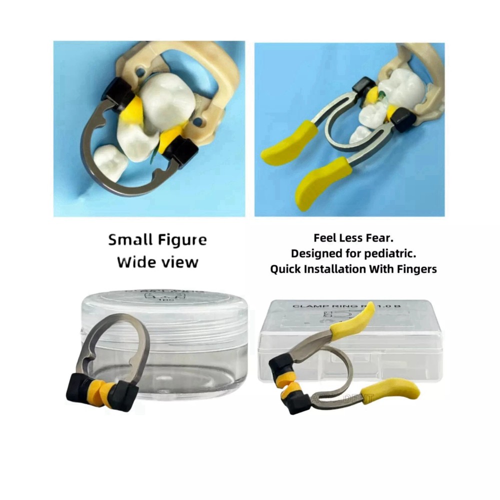 Dental Matrix Bands Ring Sectional Matrice Clamp Titanium R8 For Primary/Young