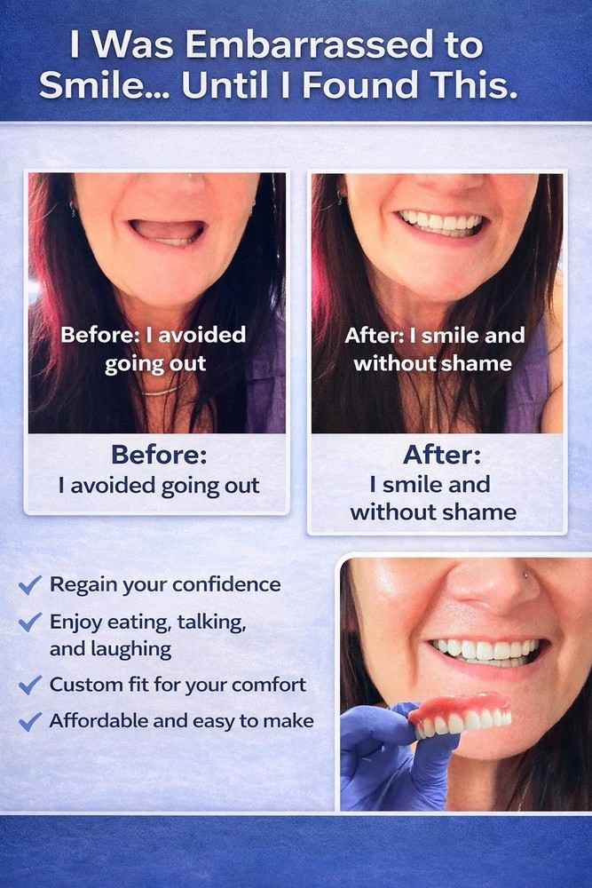 Acrylic False Teeth Only | DIY Denture Making Repair Upper Lower No Base