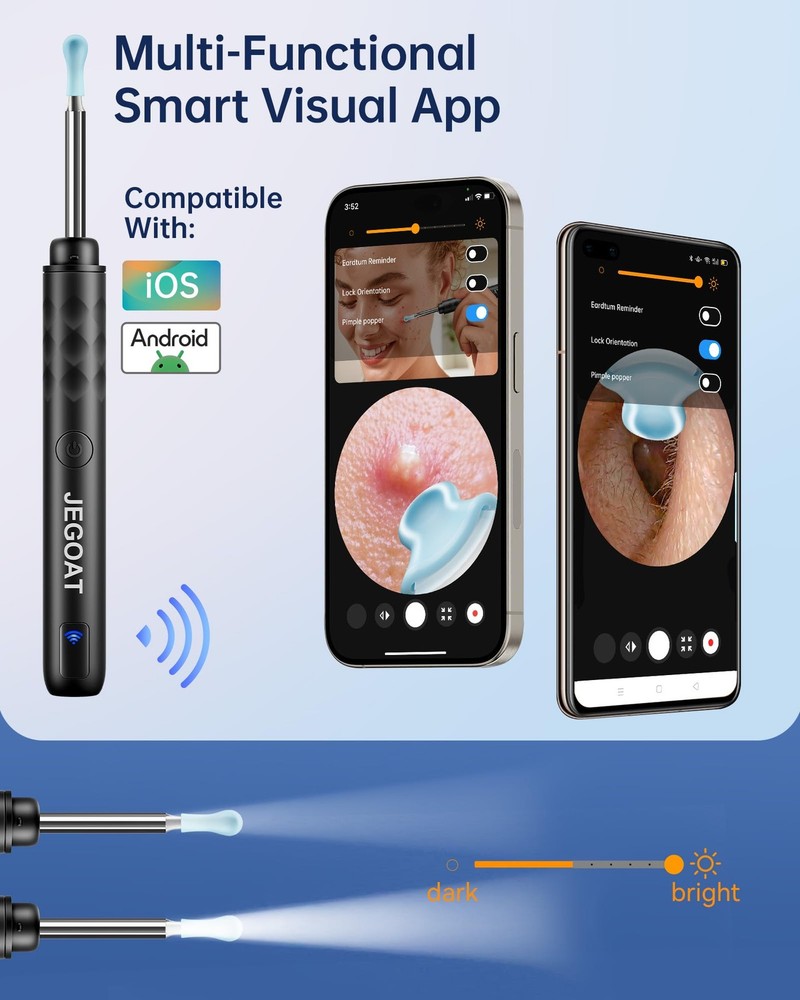 Jegoat Ear Wax Removal, Removal Tool Camera with Large, Jet Black