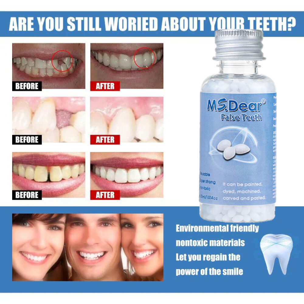 3X Tooth Repair Kit - Temporary Teeth Replacement Kit for Missing & Broken Teeth