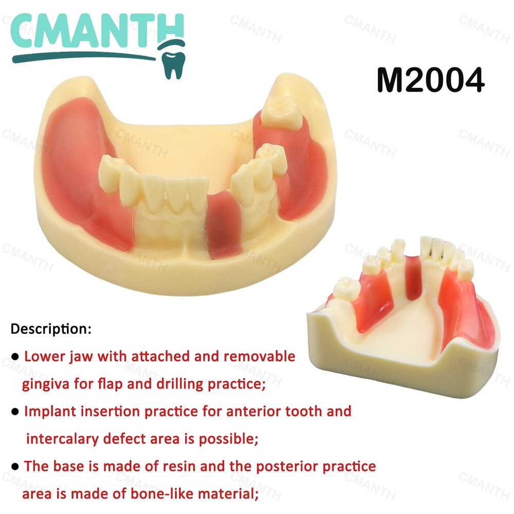 Dental Teeth Model Gingiva Removable Implant Drilling Practice Teeth Model M2004