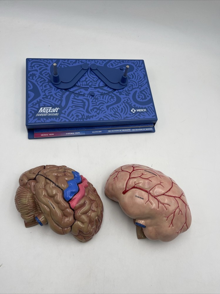 Maxalt Brain Anatomical Model Migraine Pathology Education Teaching Model
