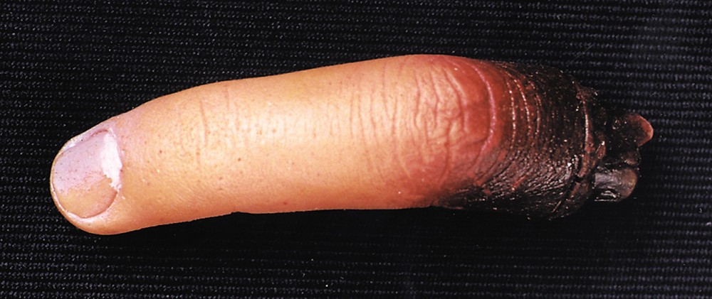 Cut Off Finger-New - Costumes4less
