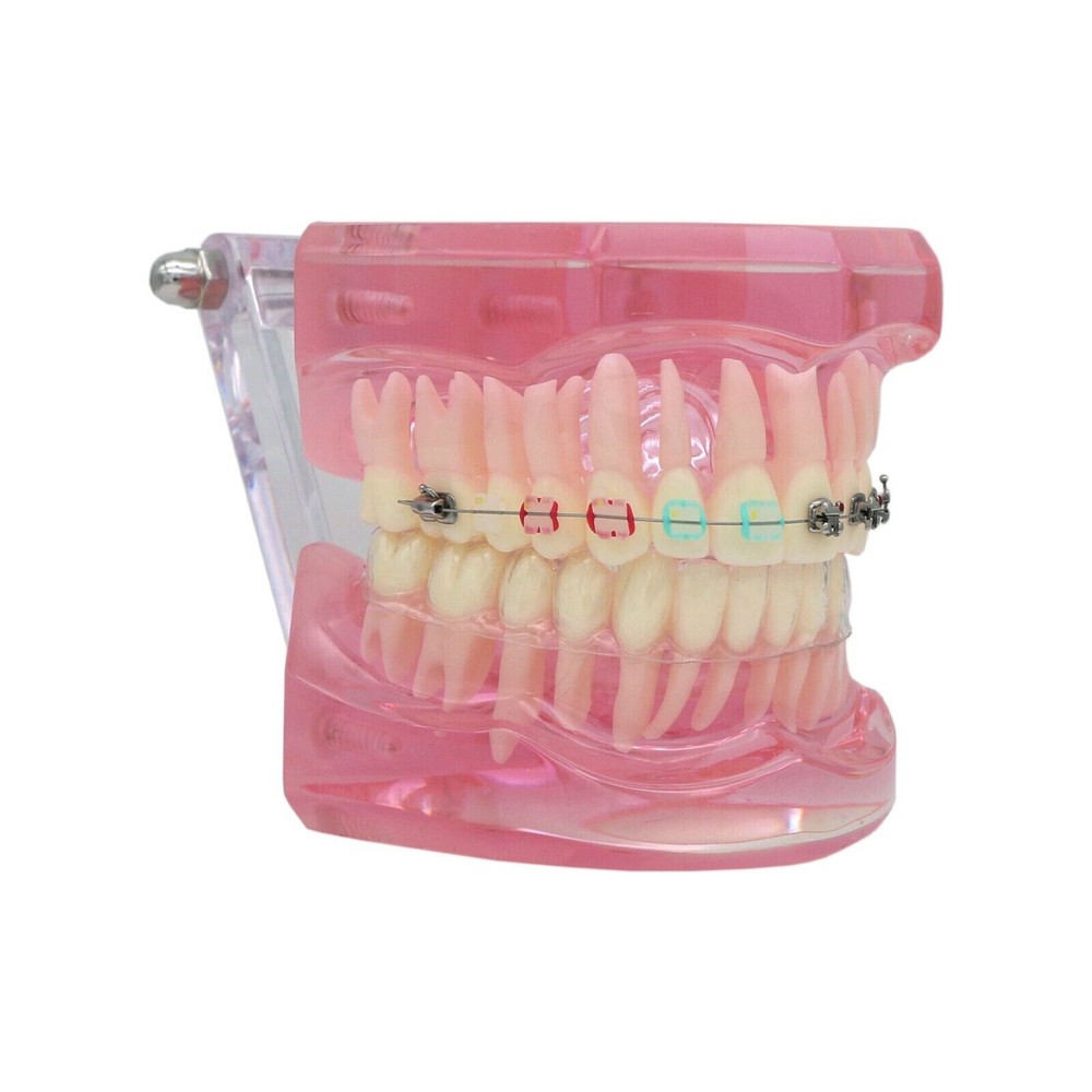 Dental Typodont Model Self-ligating Metal Bracket Ceramic Transparent Retainer