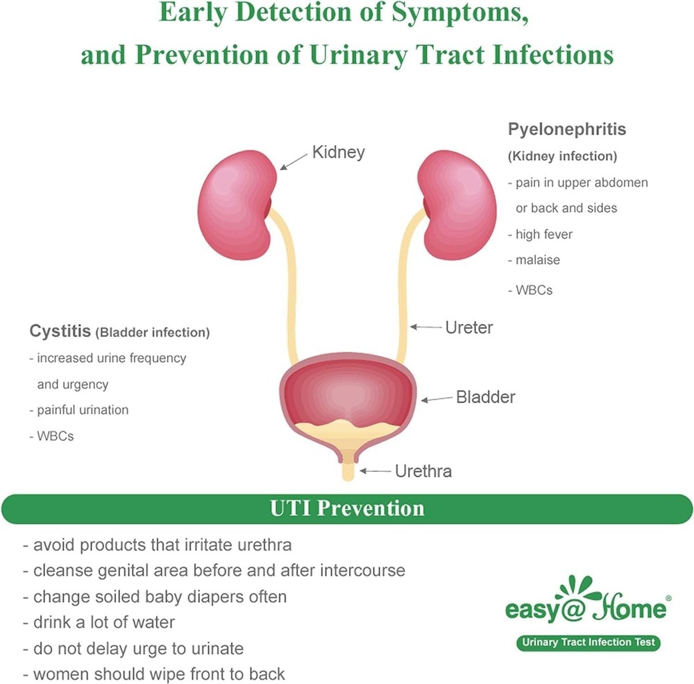 Quick 2-Minute UTI Strips - Accurate and Affordable Urinary Testing