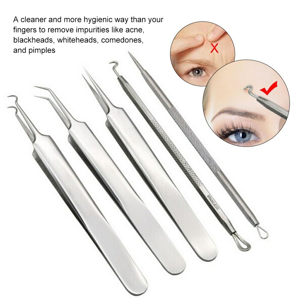 Blackhead/Whitehead Cleaner Acne Remover Comedone Extractor Tool kit SC-1109