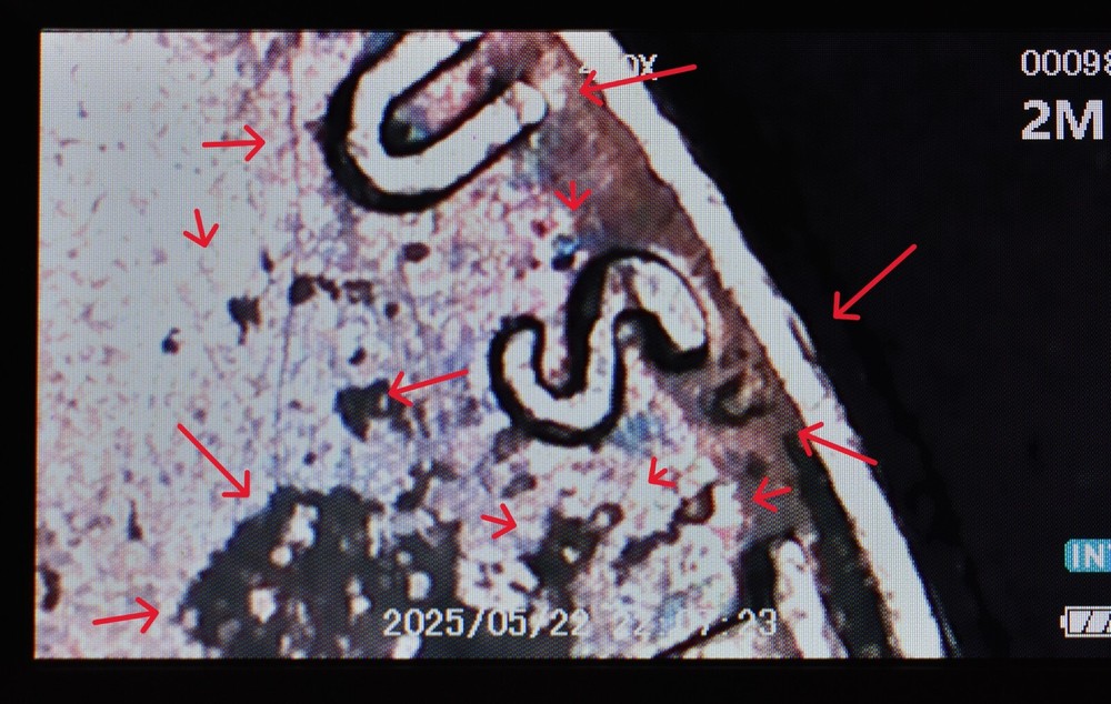 1963 Penny Error Die Break One Cent US Minted Coin Multi Error Doubling Pillars