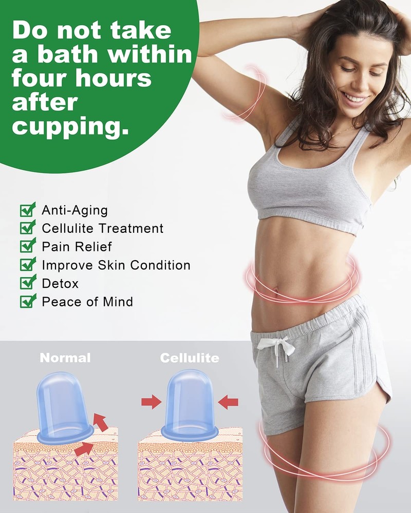 Silicone Cupping Therapy Sets, Anti Cellulite Cup Massager - 4 Pack, Skyblue