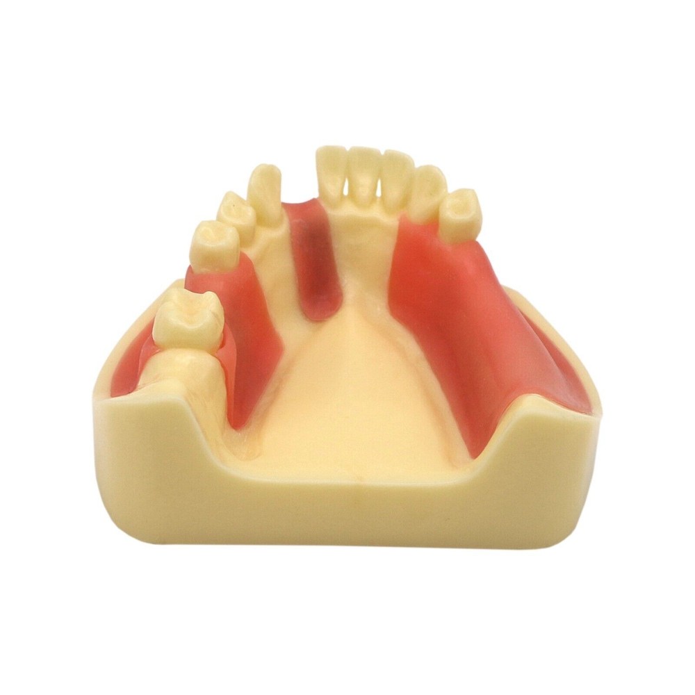 Dental Teeth Model Gingiva Removable Implant Drilling Practice Teeth Model M2004