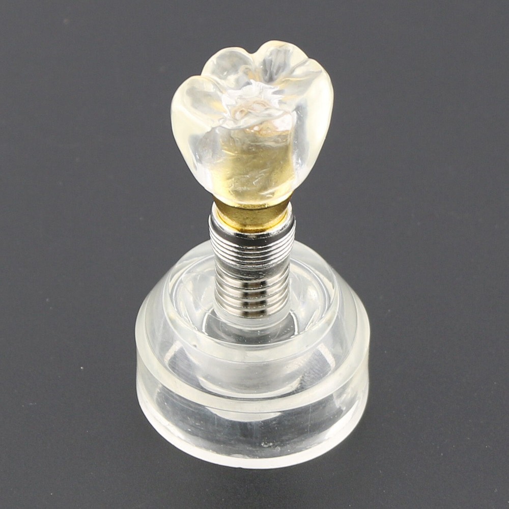 Dental Implant DemonstrationTeeth Study Teach Crown Model Acrylic Teeth Study