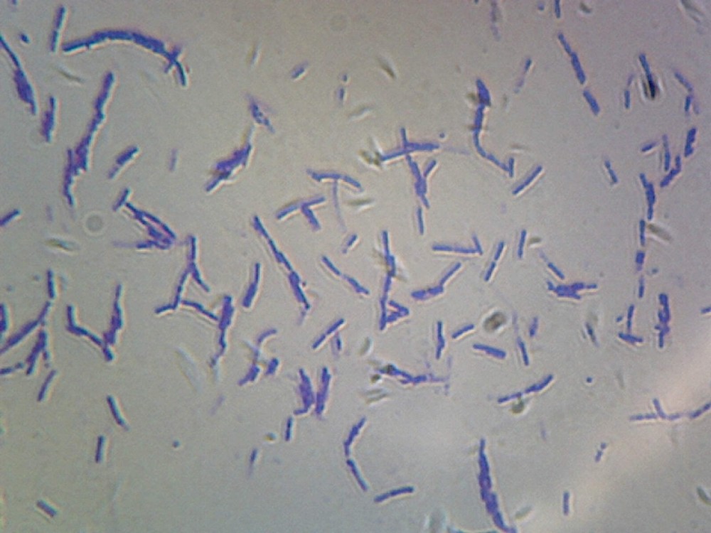 Bacteria Spores; Smear
