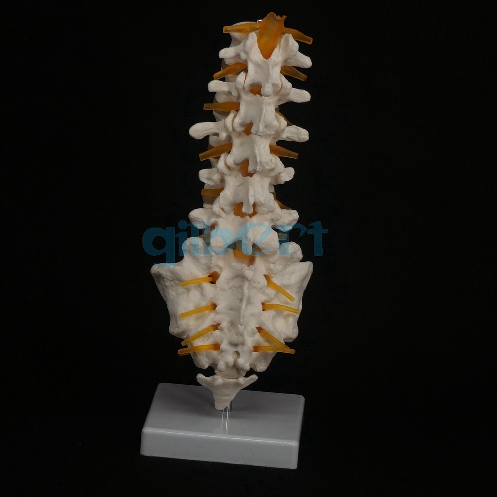 Human Lumbar Spine with Caudal Vertebra Structure Intervertebral Disc Model
