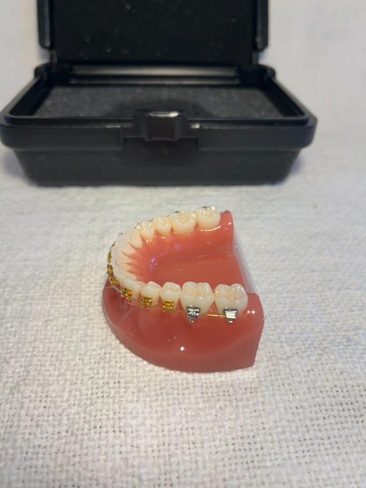 Orthodontic Study Model Dental Typodont - Gold & Silver Braces - Teaching Tool