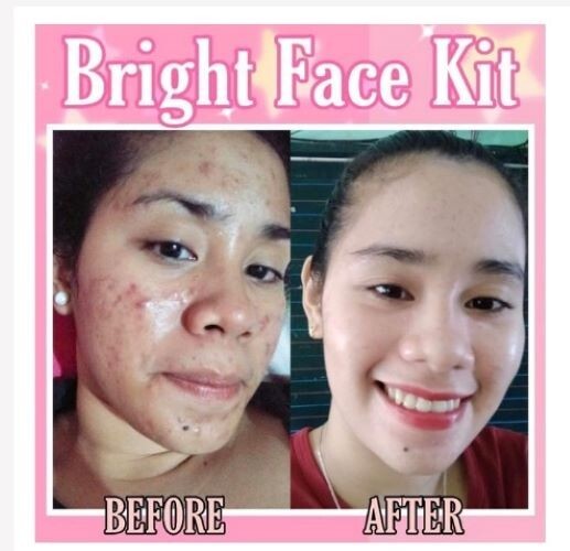 Nathiňa Bright Face Kit (Authentic)