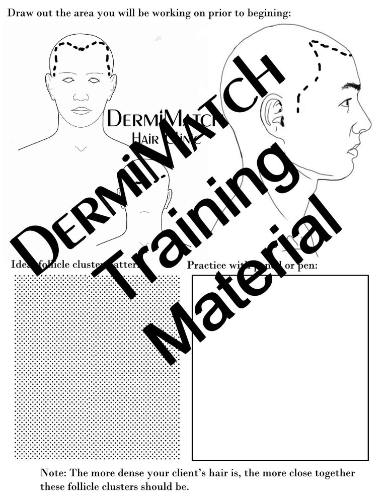 HD Scalp Micropigmentation Kit by DermiMatch