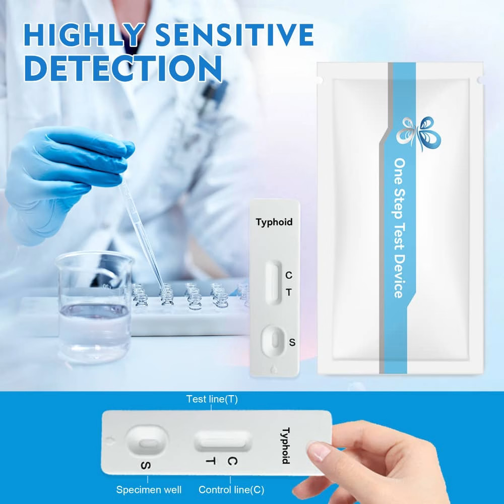 Typhoid IgG & IgM Antibody Test