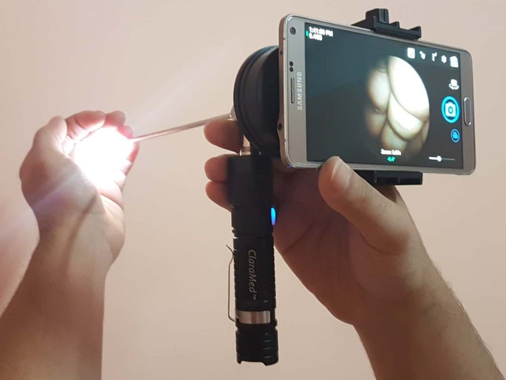 ClaraMed smartphone endoscope adapter with ACMI compatible LED light source S5