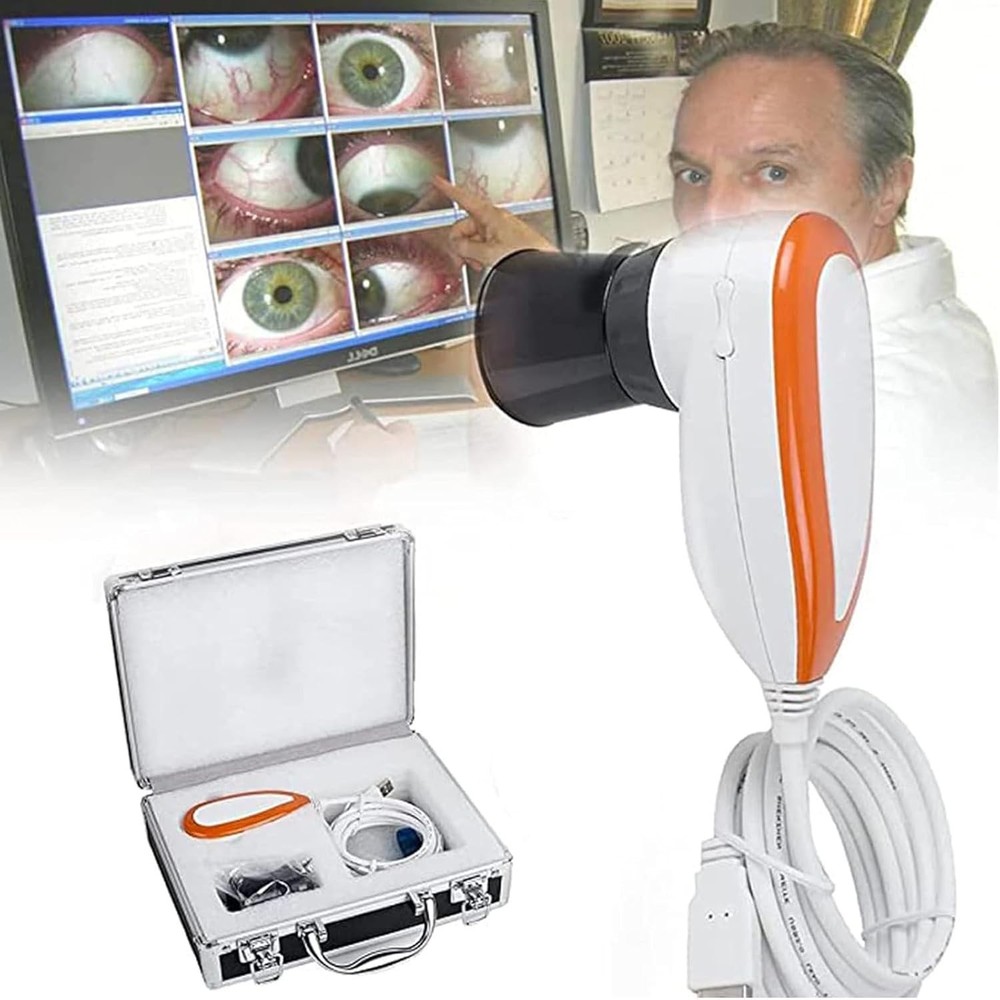Iris Analyzer Iridology Camera Iridology Analysis Camera with English Software