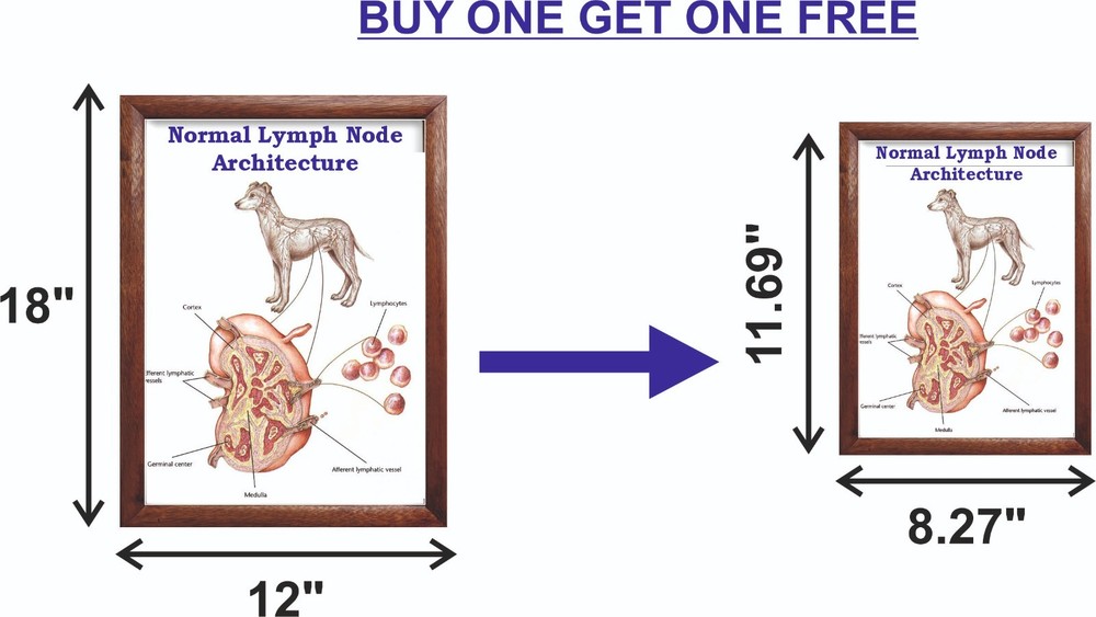 Normal Lymph Node Architecture Chart 12x18 inches