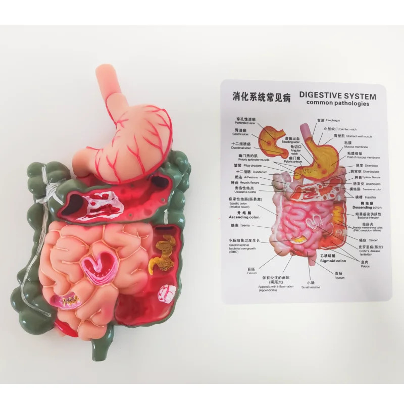 Removerable Human Stomach Anatomy Model Pathological Digestive System Model