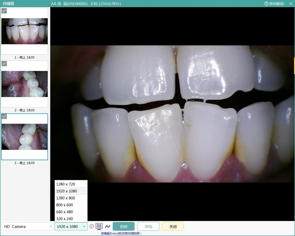 SOLARCAM 1080P USB Intraoral Camera with Software - White