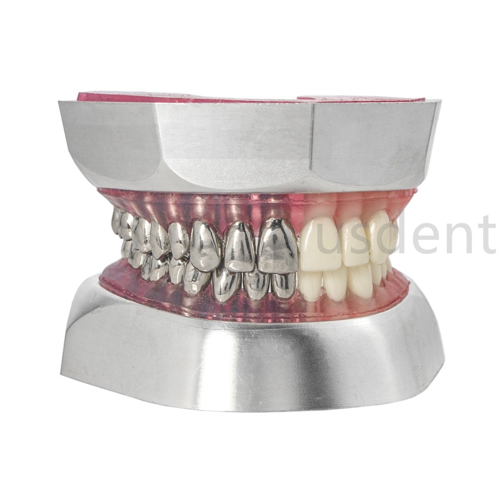 Dental Teeth Model With Restoration Learning and Teaching Demonstrate M6004