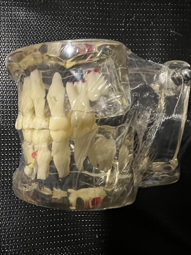 Dental Pathology Demonstration Study Tooth Teeth Model