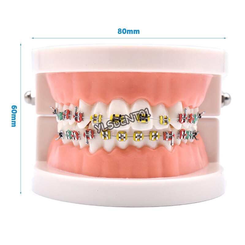 Dental Typodont Orthodontic Treatment Teeth Model Malocclusion Study w/ Bracket