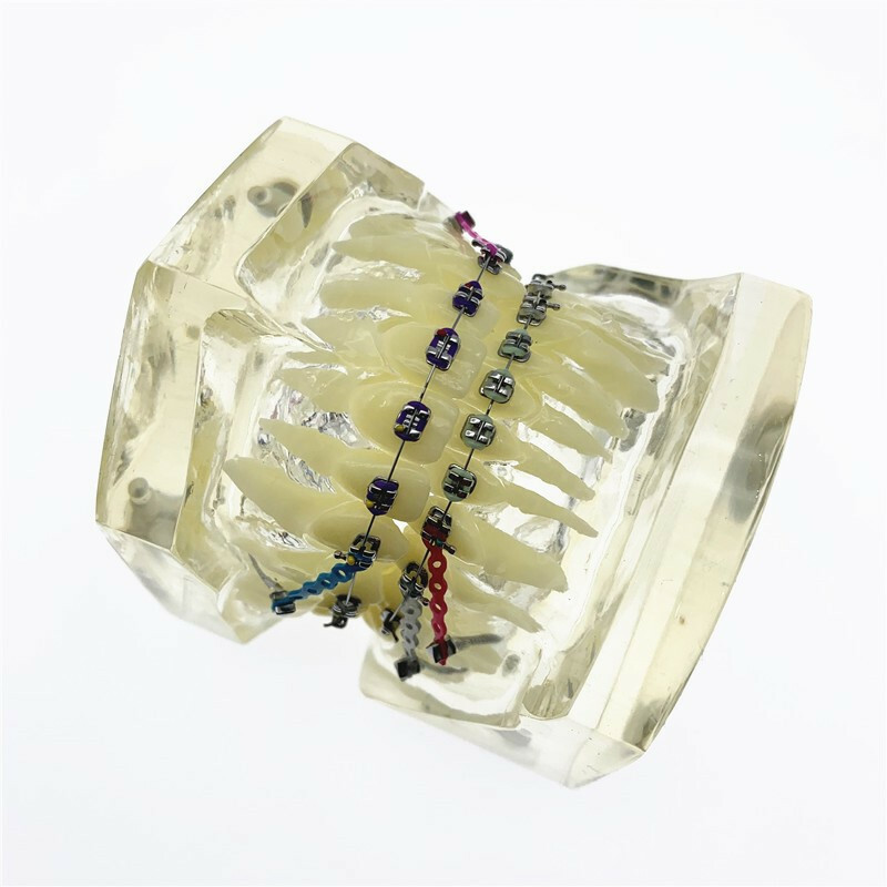 Dental Model Orthodontic Teeth Model With Brackets Chain Ties Arch Wire