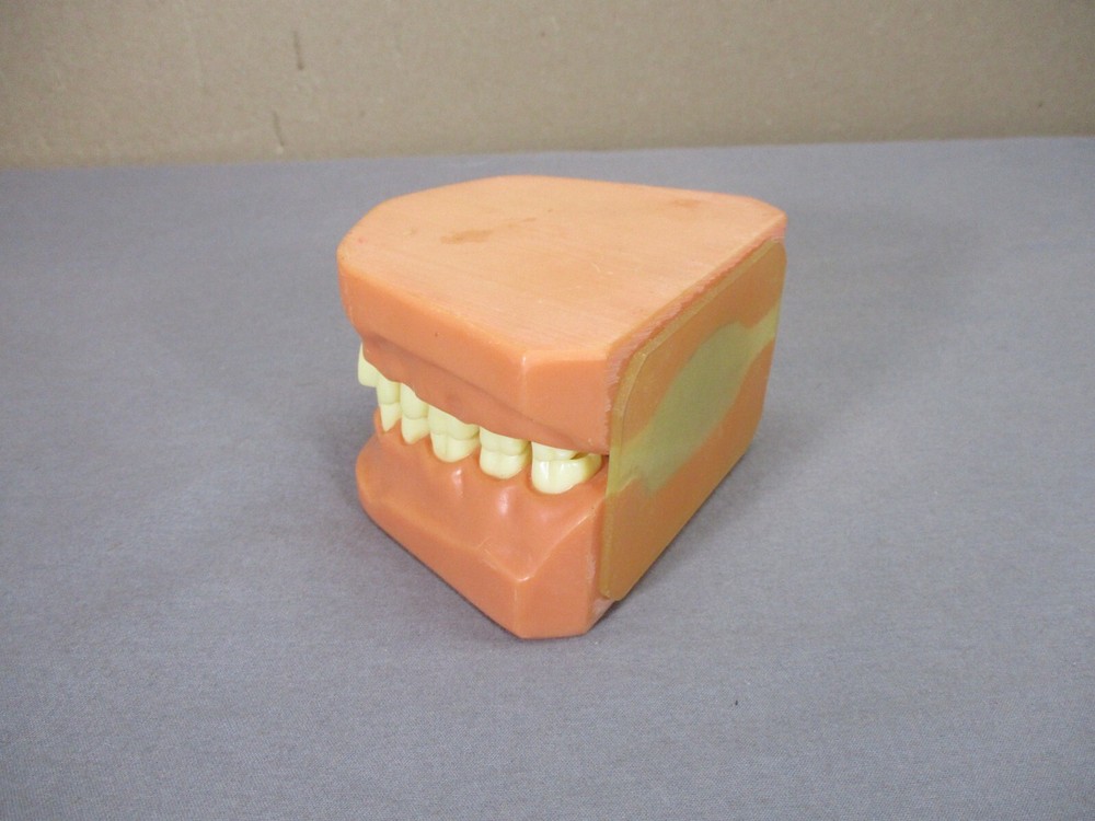 Dentist Typodont Dentoform Dental Model Teeth Overbite Tooth Display Hinged Set