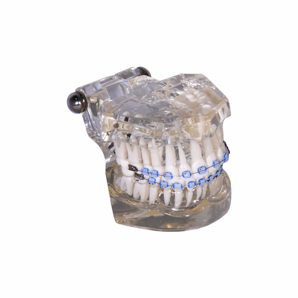 Redland Dental Demonstration Teeth Educational Model orthodontics