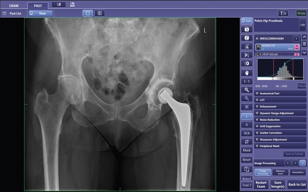 digital portable machine Canon cxdi NX