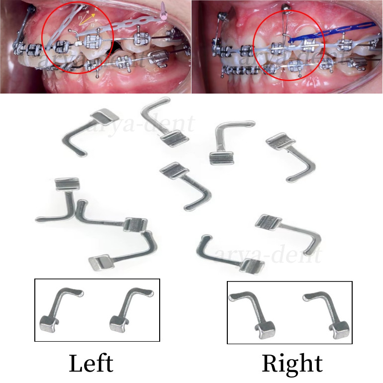 10pcs/pack Dental Orthodontic 90degrees Crimpable Hooks Right/Left Bending Hook