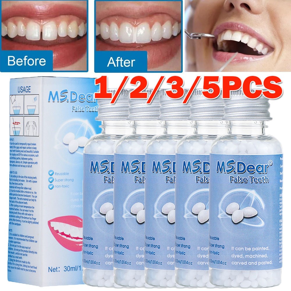 Tooth Repair Kit - Temporary Teeth Replacement Kit for Missing & Broken Teeth