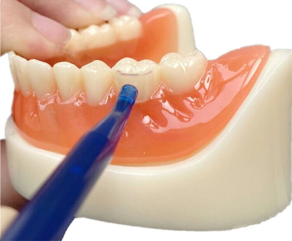 Dental Transparent Cervical Matrices Composite Veneer Gingival Retractor Matrix