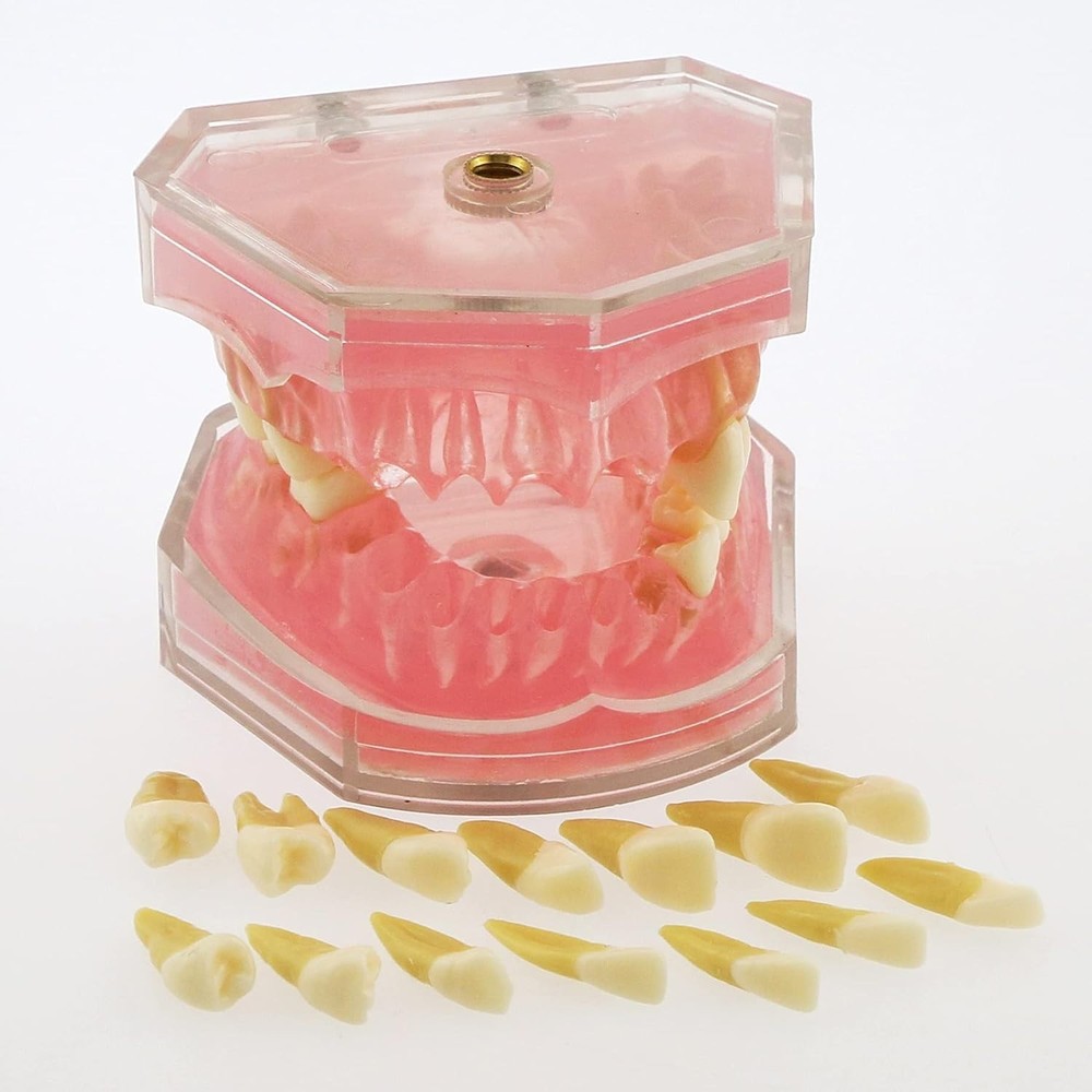 Dental Demonstration Teeth Model - Standard Study Teaching Dental Mode with A...