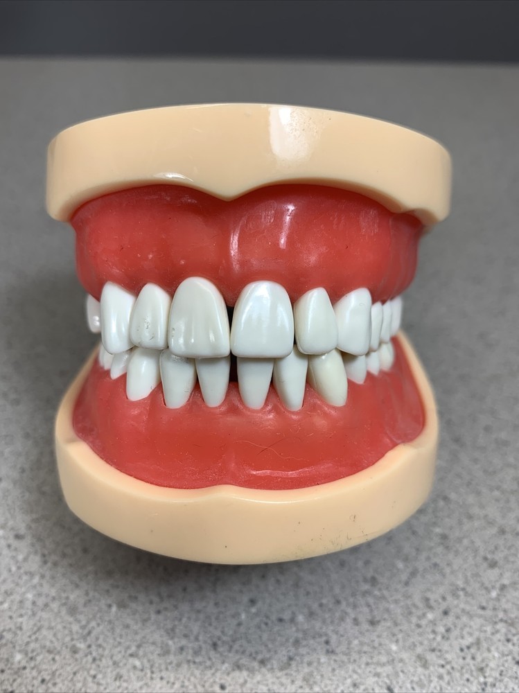 Dental Typodont Model With Removable Teeth Unbranded